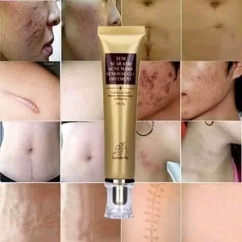 Lanbena TCM Scar And Acne Mark Removal Cream