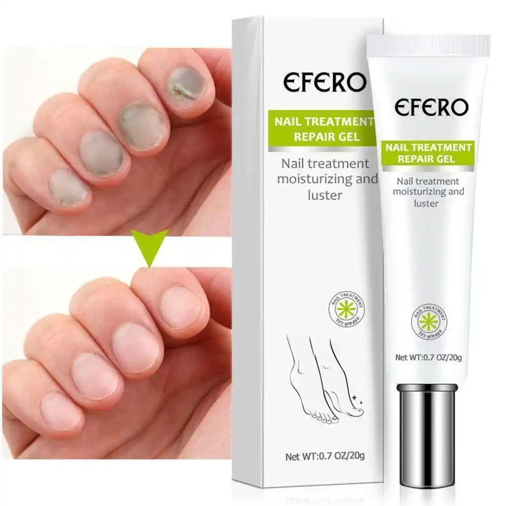 Efero Nail Treatment Repair Gel